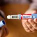 Ozempic Scare Goes Viral: Is the Weight-Loss Drug Really ‘Destroying Bones